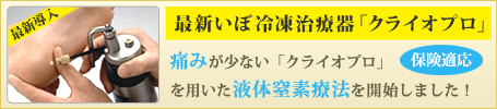 最新いぼ冷凍治療器「クライオプロ」