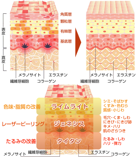 表皮・真皮図