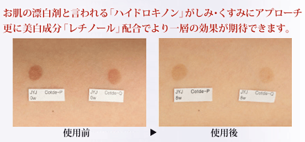 お肌の漂白剤と言われる「ハイドロキノン」がしみ・くすみにアプローチ